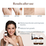 Cyperus Rotundus Oil for Hair Removal 2 PACKS – 100% Pure Natural Cyprus Oil – Organic Herbal Cypress Root Extract for Smooth Skin, Reducing Body Hair Growth, Ingrown Hair & Nourishment – 60ml