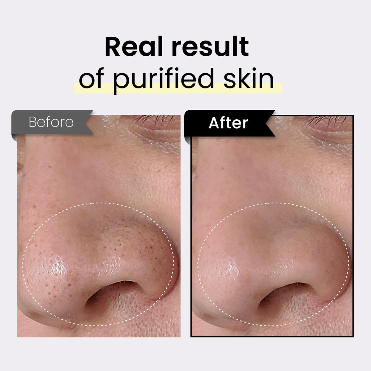 Coxir TXA Black Rice Pore Mask – Korean 3-in-1 Wash-Off Mask Serum| Pore Purifying, Blackhead Care, Hydrating, Skin Toning Treatment with TXA & Black Rice |Vegan K-beuaty Face Mask [50ml/1.69 fl.oz]