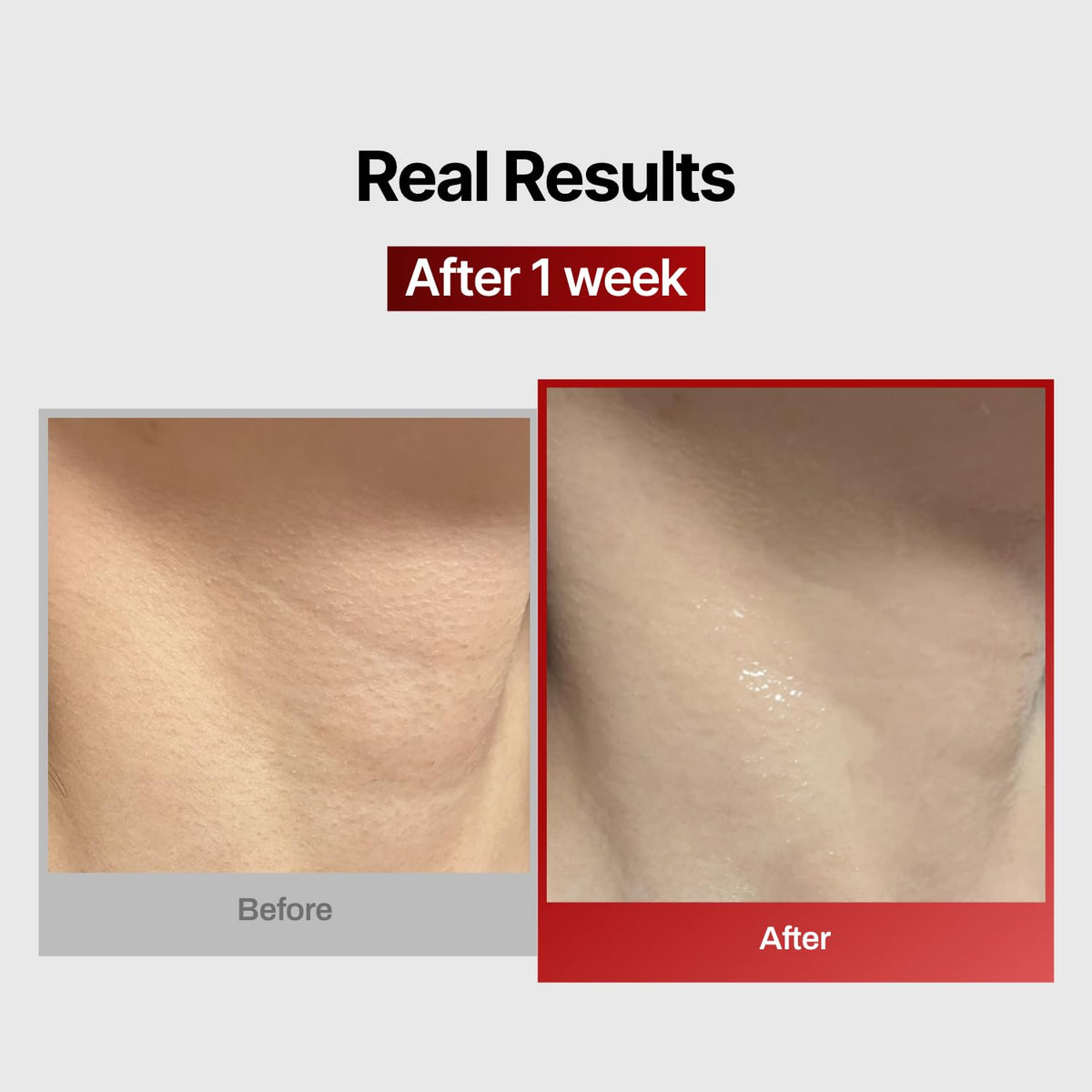 Wrinkle-fit Neck Mask - Neck Wrinkle Patches, Firming and Tightening Korean Deep Collagen Masks - Hyaluronic Acid NeckTargeted Mesh Sheet Mask for Lifting Sagging Skin - Boosting Elasticity 7EA