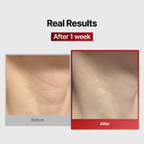 Wrinkle-fit Neck Mask - Neck Wrinkle Patches, Firming and Tightening Korean Deep Collagen Masks - Hyaluronic Acid NeckTargeted Mesh Sheet Mask for Lifting Sagging Skin - Boosting Elasticity 7EA