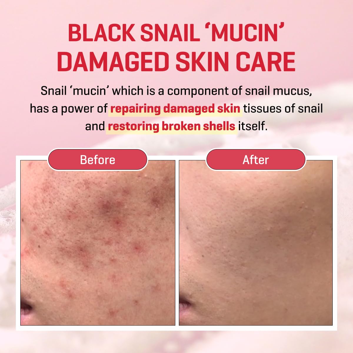 SOME BY MI Snail Truecica Miracle Repair Low pH Gel Cleanser - 3.38Oz, 100ml - Made from Snail Mucin for Sensitive Skin - Daily Face Wash for Deep Cleansing and Skin Moisturizing - Korean Skin Care