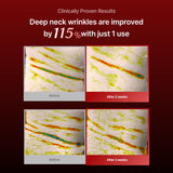 Wrinkle-fit Neck Mask - Neck Wrinkle Patches, Firming and Tightening Korean Deep Collagen Masks - Hyaluronic Acid NeckTargeted Mesh Sheet Mask for Lifting Sagging Skin - Boosting Elasticity 7EA