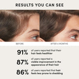 OUAI Scalp Serum - Balancing Hair Serum with Red Clover Extract, Siberian Ginseng and Peptides for Thicker and Fuller-Looking Hair - Paraben, Phthalate and Sulfate Free Scalp Care (2 Fl Oz)