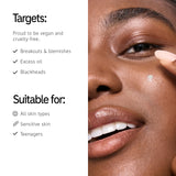 The INKEY List Succinic Acid Treatment 15ml, Clears Blemishes, Acne Treatment, Vegan Friendly, Suitable For All Skin Types