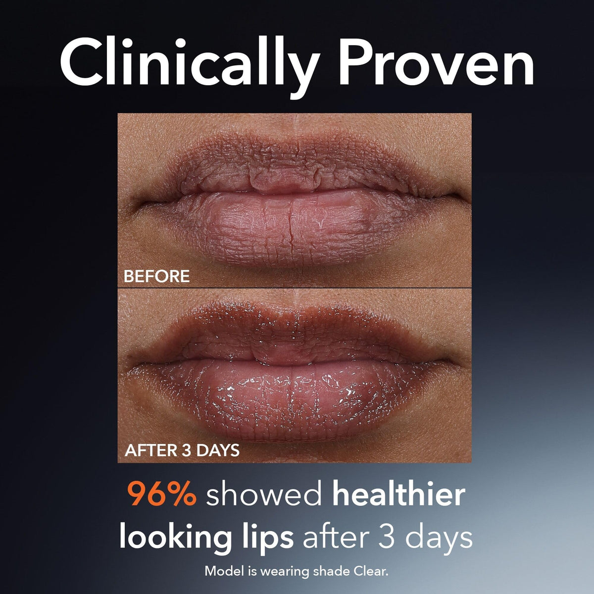 Dr Dennis Gross DermInfusions Plump + Repair Tinted Lip Treatment, Clear - Visibly Plumps & Defines Lips with Hyaluronic Acid & Peptides - Repairs Moisture Barrier - 10 mL