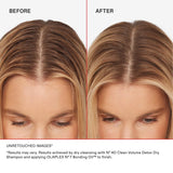 Olaplex Nº.4D Clean Weightless Volume Healthy Scalp Dry Shampoo: Absorbs Oils & Neutralizes Odor | No Powdery Residue | For Coily, Curly, Straight, and Wavy, 178 g / 6.3 Oz